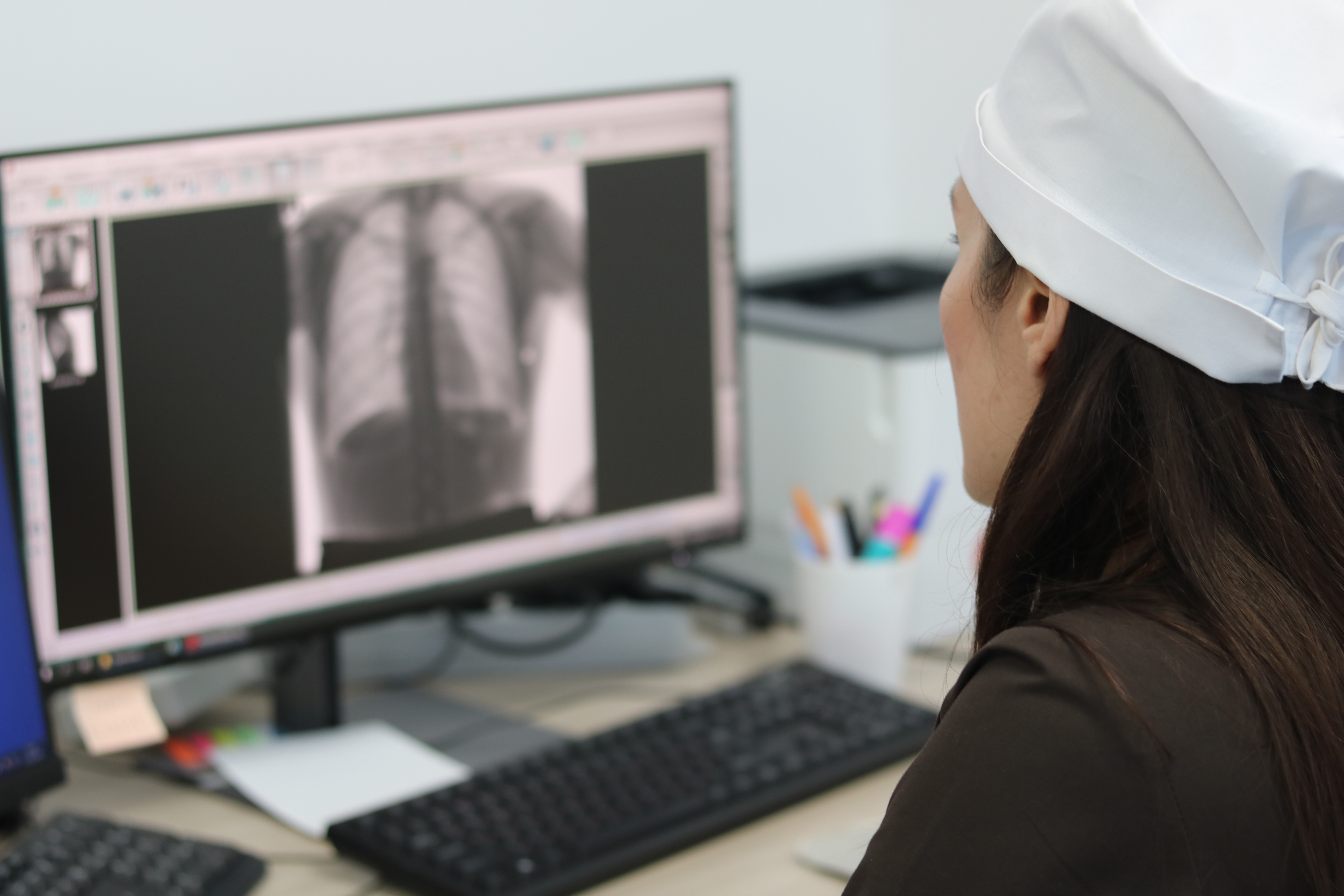 В Севастопольском противотуберкулезном диспансере прошел День открытых дверей, приуроченный ко Всемирному дню борьбы против туберкулеза