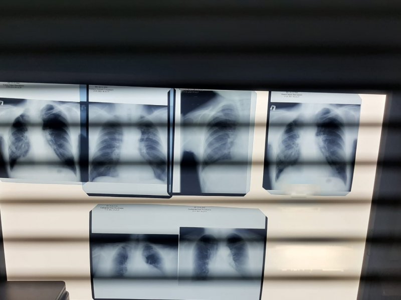 Сегодня в Севастополе началась «Неделя лёгочного здоровья»