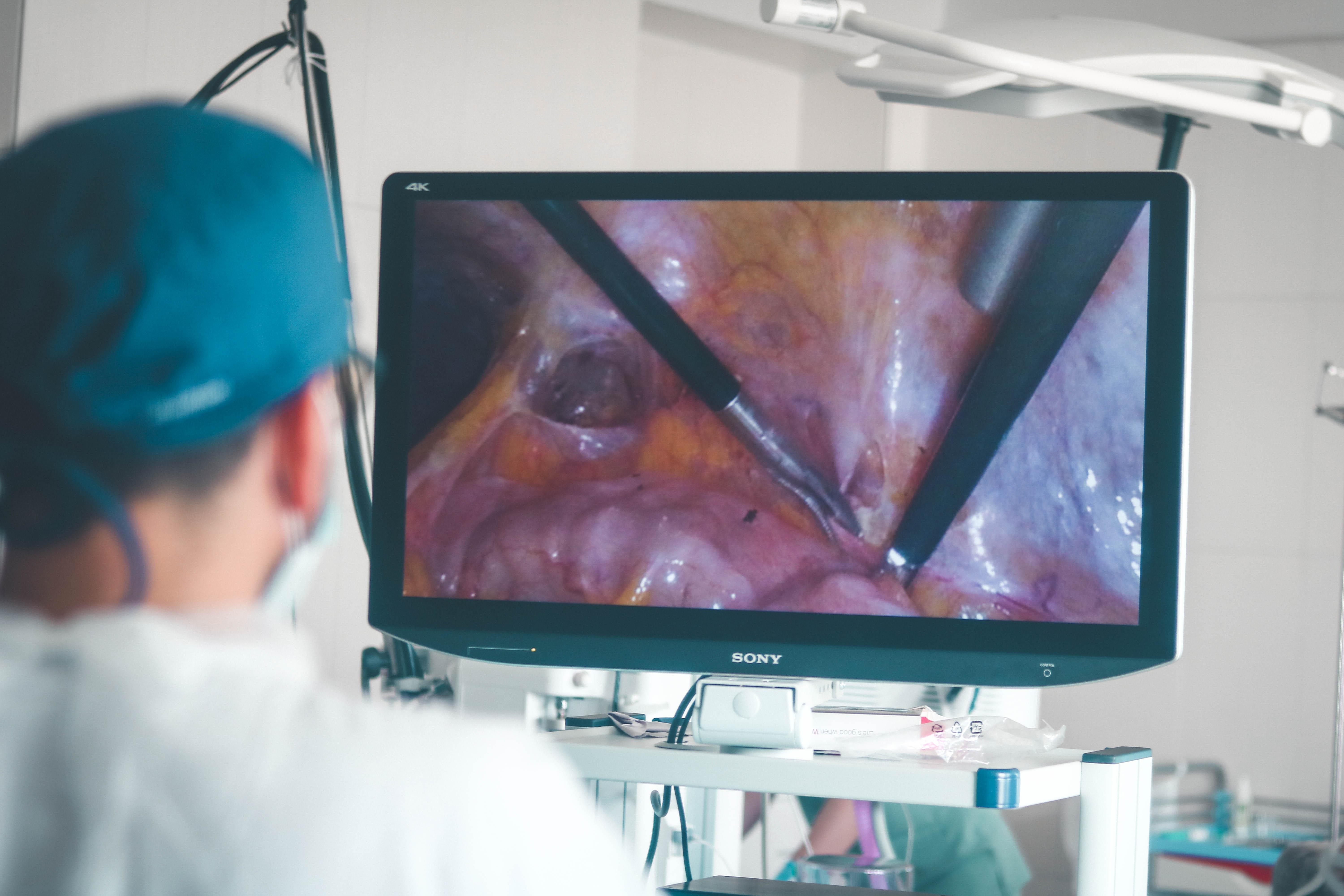 Эндоскопическая 3D-визуализация стала доступна в отделении хирургических методов лечения Севастопольского онкологического диспансера