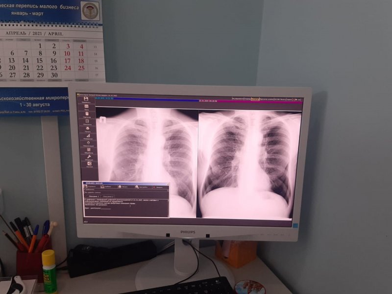 Сегодня в Севастополе началась «Неделя лёгочного здоровья»