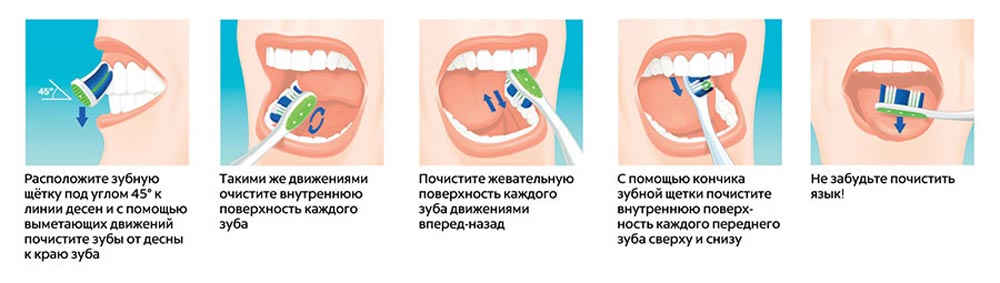 Частные фото как правильно Как правильно чистить зубы? Расскажем!
