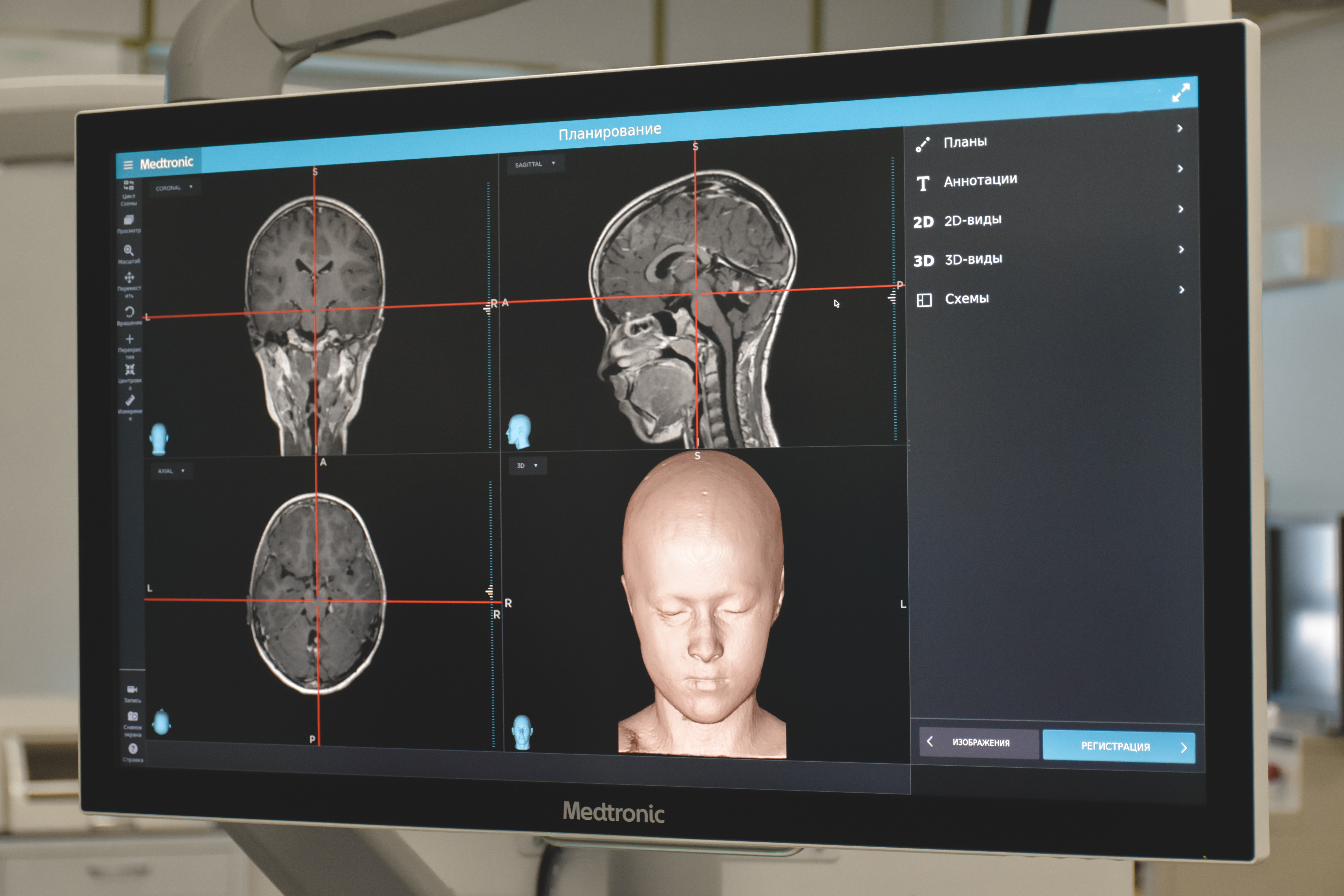 Теперь во время операции мы видим больше: в детской Городской больнице № 5 появилась ультрасовременная хирургическая навигационная станция