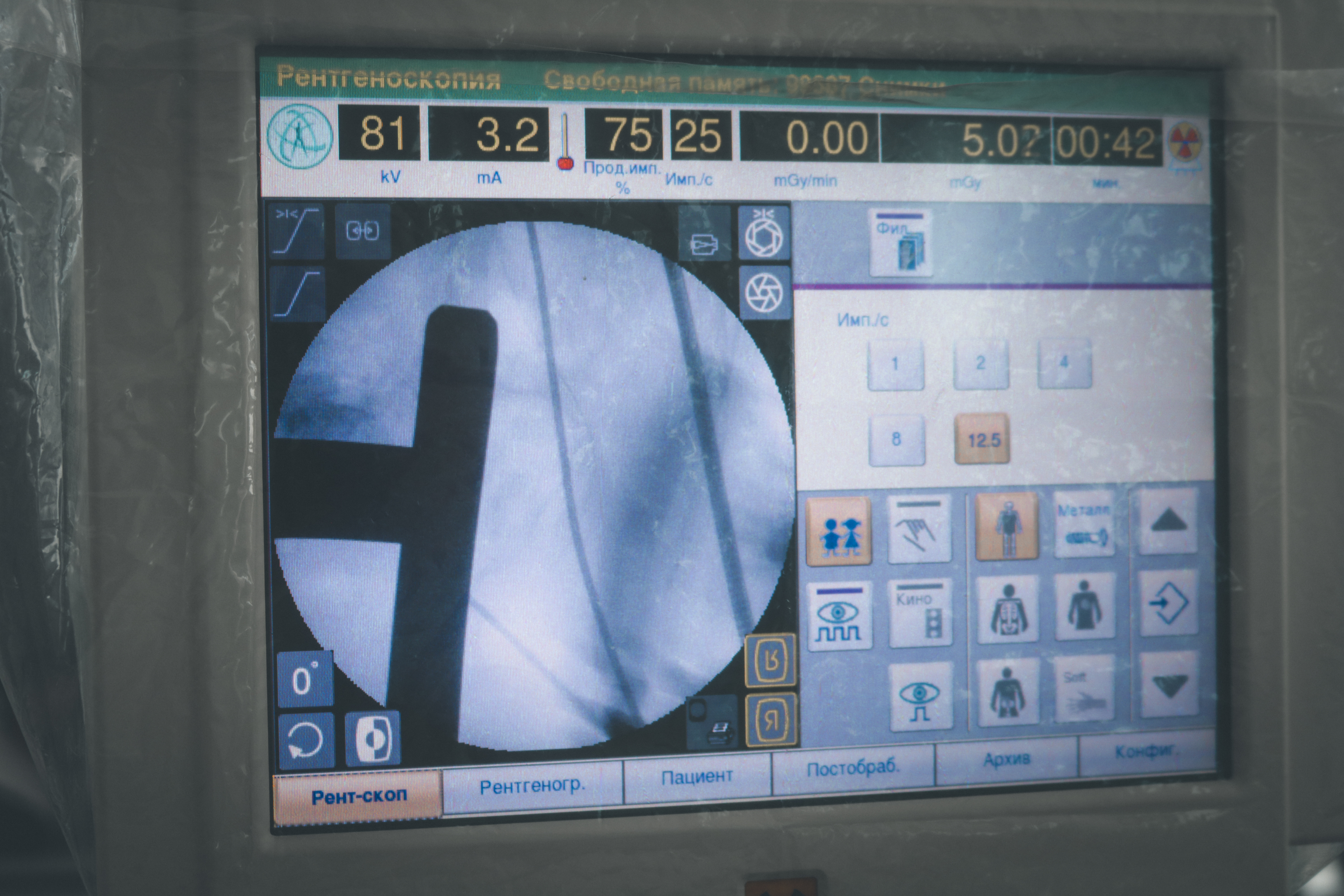 Передовой урологический комплекс: в Городской больнице № 9 операции делают на новом оборудовании