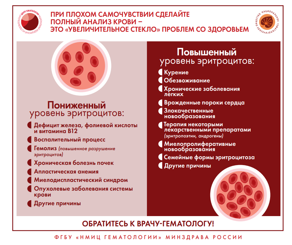 Признаки и симптомы неходжкинской лимфомы