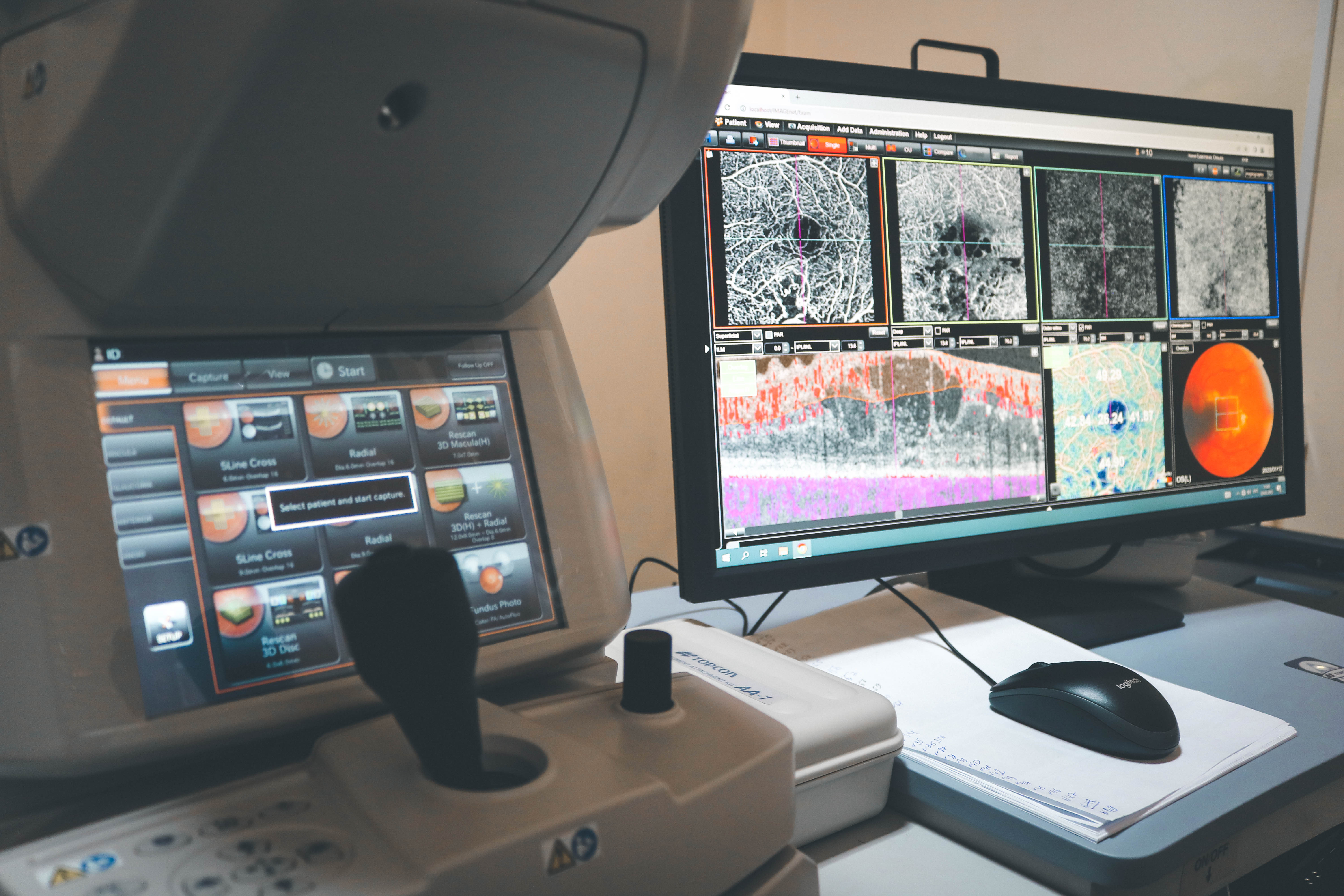 Время диагностики и риски для пациента снижены: в офтальмологическое отделение поступило новое оборудование