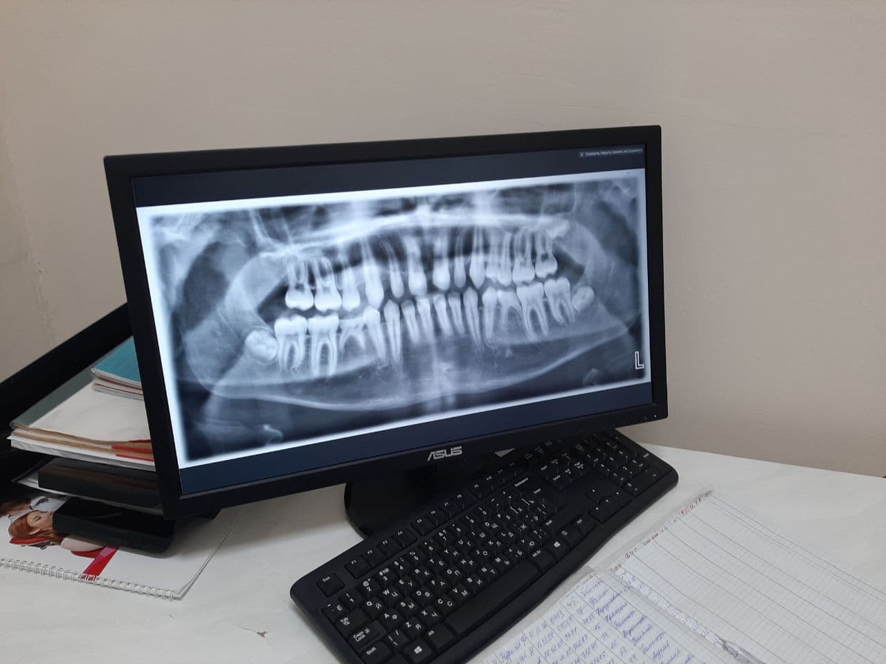 В детской стоматологии Севастополя появилось новое оборудование