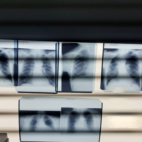 Сегодня в Севастополе началась «Неделя лёгочного здоровья»