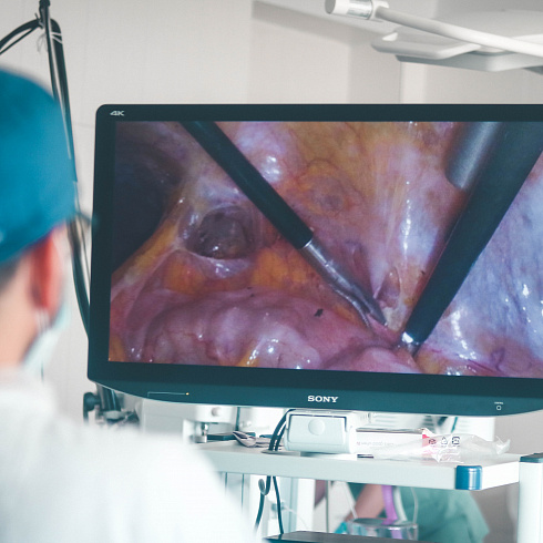 Эндоскопическая 3D-визуализация стала доступна в отделении хирургических методов лечения Севастопольского онкологического диспансера