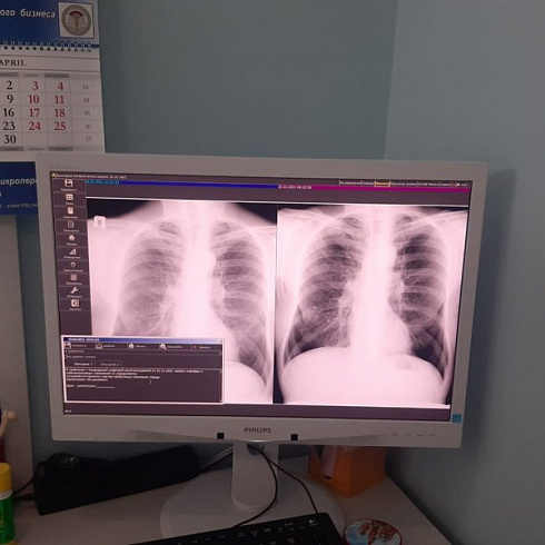 Сегодня в Севастополе началась «Неделя лёгочного здоровья»