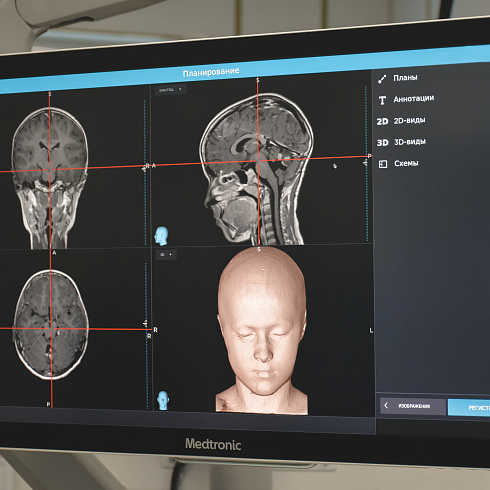 Теперь во время операции мы видим больше: в детской Городской больнице № 5 появилась ультрасовременная хирургическая навигационная станция