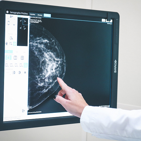 Работа на новом оборудовании: в поликлинике № 1 запущен новейший маммограф