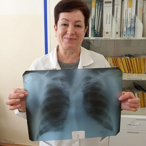 Мы здоровы! Севастопольский противотуберкулёзный диспансер запускает флешмоб #Севастопольбезтуберкулёза