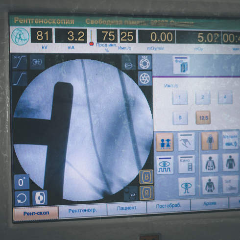 Передовой урологический комплекс: в Городской больнице № 9 операции делают на новом оборудовании