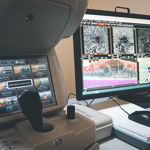 Время диагностики и риски для пациента снижены: в офтальмологическое отделение поступило новое оборудование