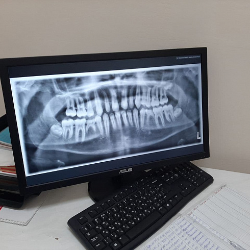 В детской стоматологии Севастополя появилось новое оборудование